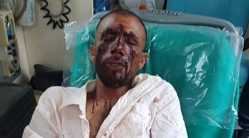 Δολοφονική επίθεση χρυσαυγιτών σε μετανάστες καταγγέλλει η ΚΕΕΡΦΑ – Σκληρές εικόνες