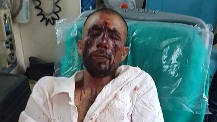 Καταδικάζουν τα κόμματα την επίθεση κατά μεταναστών στον Ασπρόπυργο