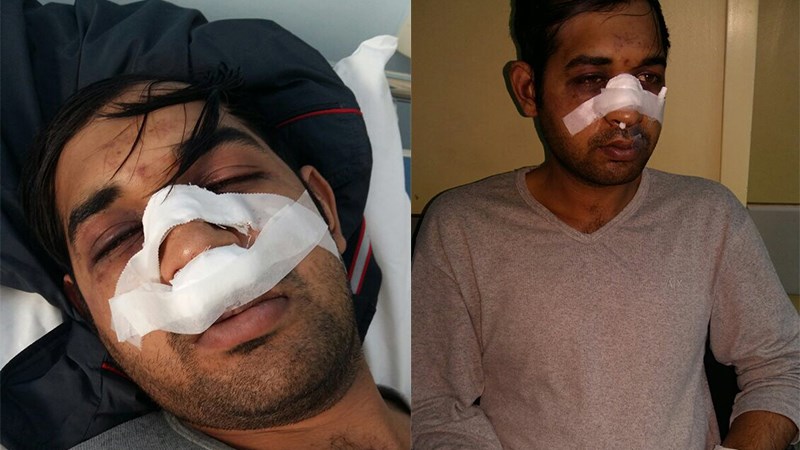 Νέα επίθεση κατά εργαζόμενου μετανάστη καταγγέλλει η ΚΕΕΡΦΑ – Σοκαριστικές εικόνες