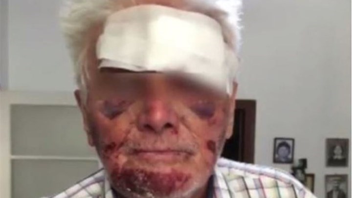 Συνελήφθησαν οι επικίνδυνοι ληστές που είχαν ξυλοκοπήσει 90χρονο για πέντε ευρώ στο Γαλάτσι