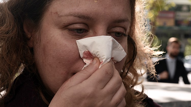 Ο συνήγορος Πολιτικής Αγωγής για την επίθεση της Χ.Α. στο Εφετείο: Δεν χτυπήθηκε τυχαία η δικηγόρος