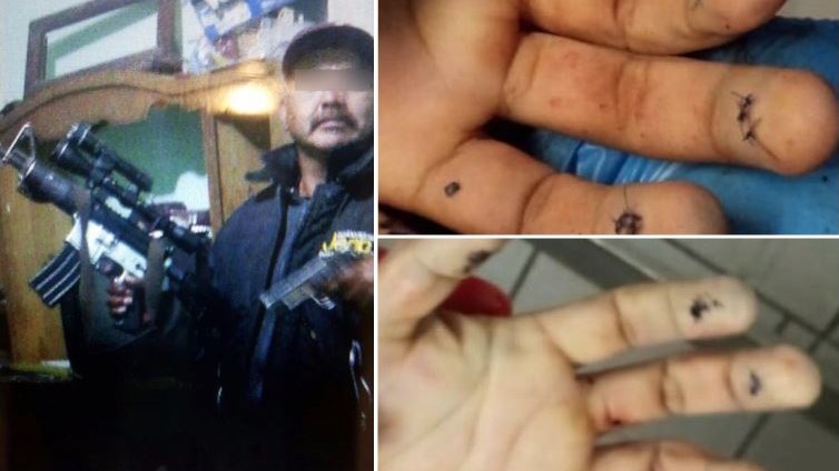 Μεξικό: Ο εγκέφαλος καρτέλ δολοφονήθηκε την ώρα που έκανε επέμβαση πλαστικής για να αλλάξει εμφάνιση