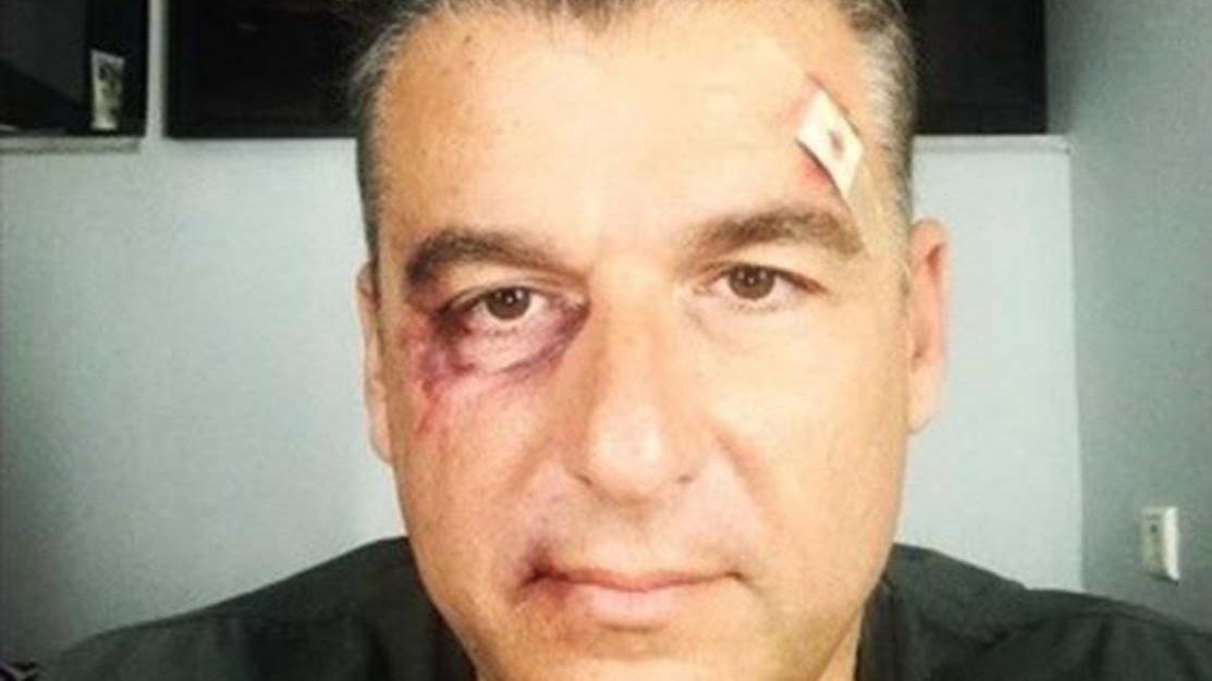 Ο Λιάγκας απαντά σε όσους ευχήθηκαν να πεθάνει – ΦΩΤΟ