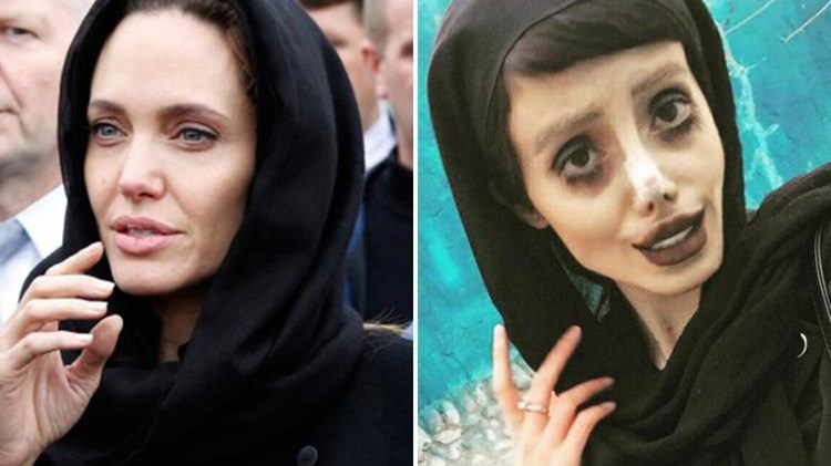 Viral:  19χρονη έκανε 50 πλαστικές επεμβάσεις για να μοιάζει στην Αντζελίνα Τζολί και έγινε…ζόμπι