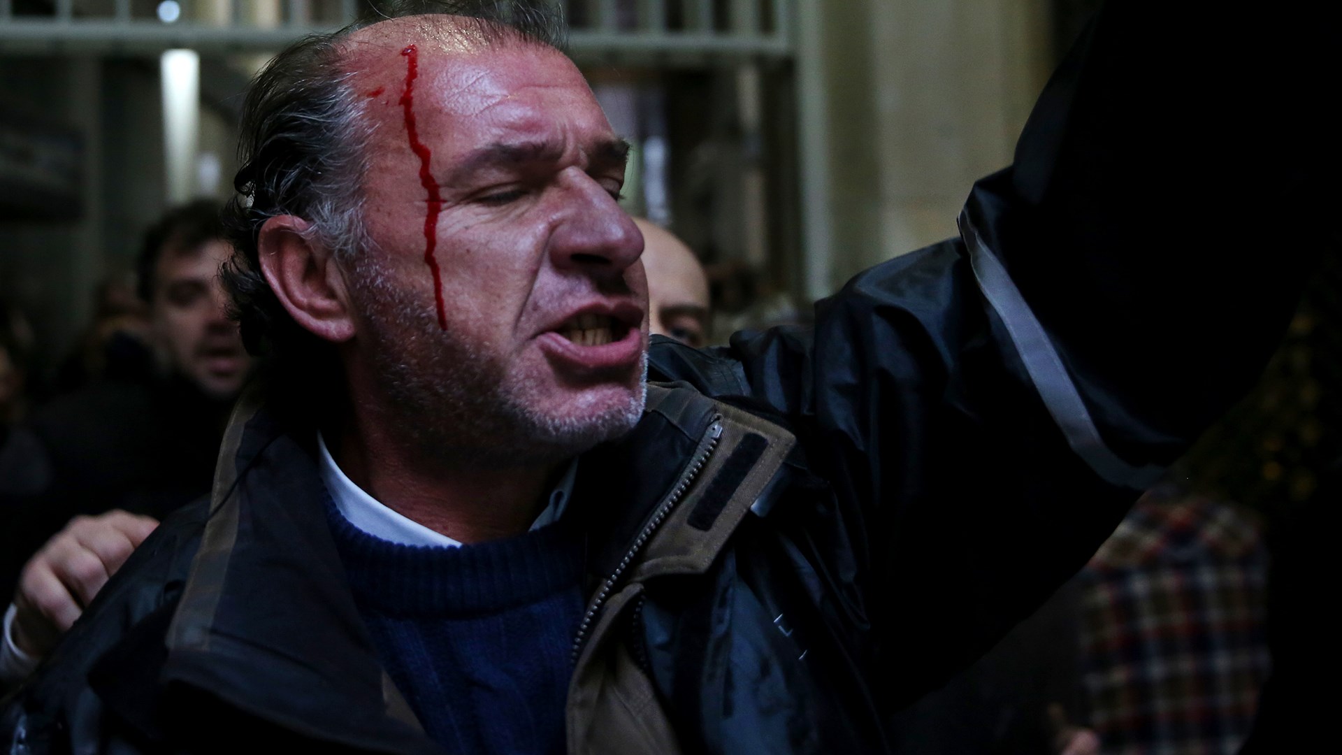 Διαδηλωτής τραυματίστηκε στα επεισόδια έξω από το υπουργείο Εργασίας – ΦΩΤΟ