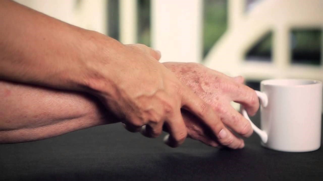 Αυτή είναι η «ασπίδα» κατά του Πάρκινσον