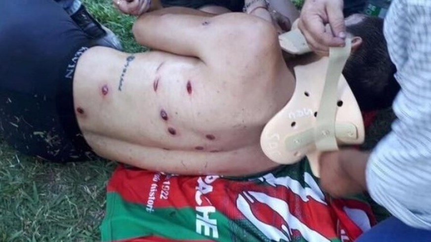 Αδιανόητο – Αστυνομικοί πυροβόλησαν ποδοσφαιριστές με σφαίρες καουτσούκ – ΣΚΛΗΡΕΣ ΕΙΚΟΝΕΣ