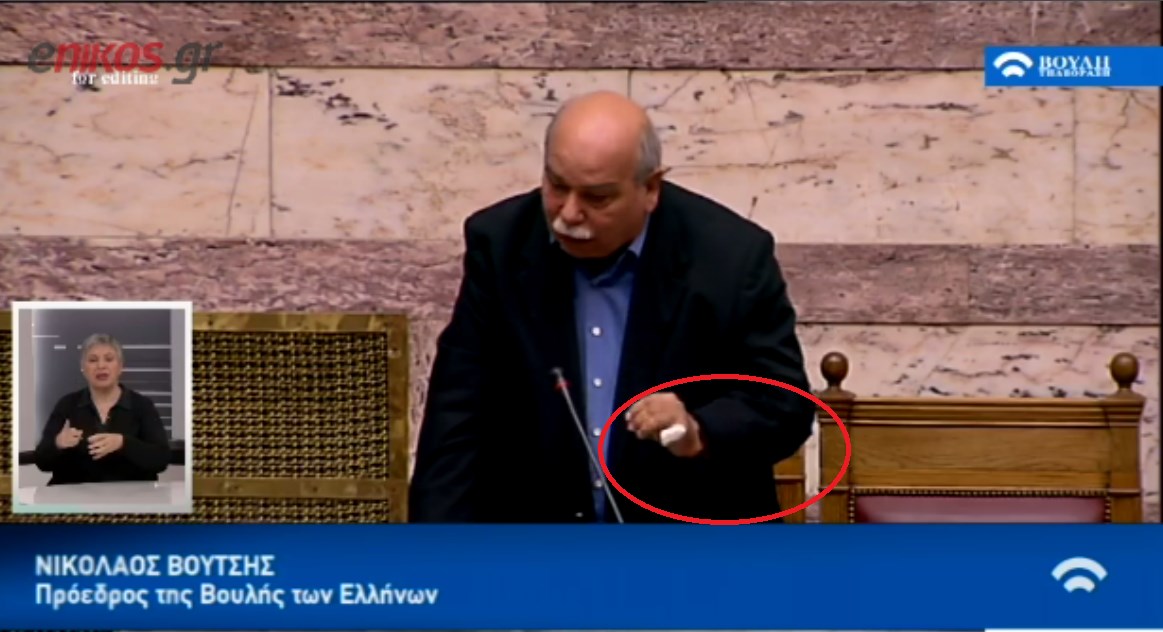 Με “μπαταρισμένο” δάχτυλο ο Βούτσης στη βουλή – Δείτε τι του συνέβη – ΦΩΤΟ