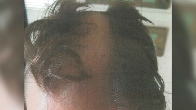 Κουρέας να σου πετύχει! Του πετσόκοψε ακόμα και… το αυτί – ΦΩΤΟ