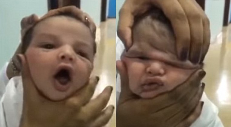 Ντροπή – Νοσοκόμες βασάνιζαν βρέφος και γελούσαν – ΒΙΝΤΕΟ