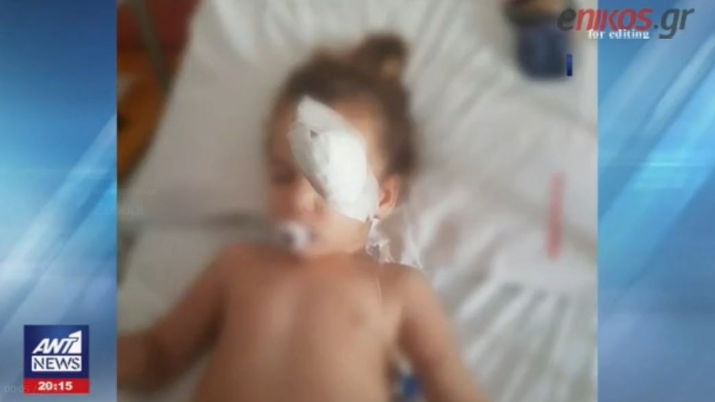 Συγκλονίζουν οι εικόνες του 3χρονου αγοριού που τραυματίστηκε σοβαρά από σφαίρα στο Ζεφύρι – ΒΙΝΤΕΟ