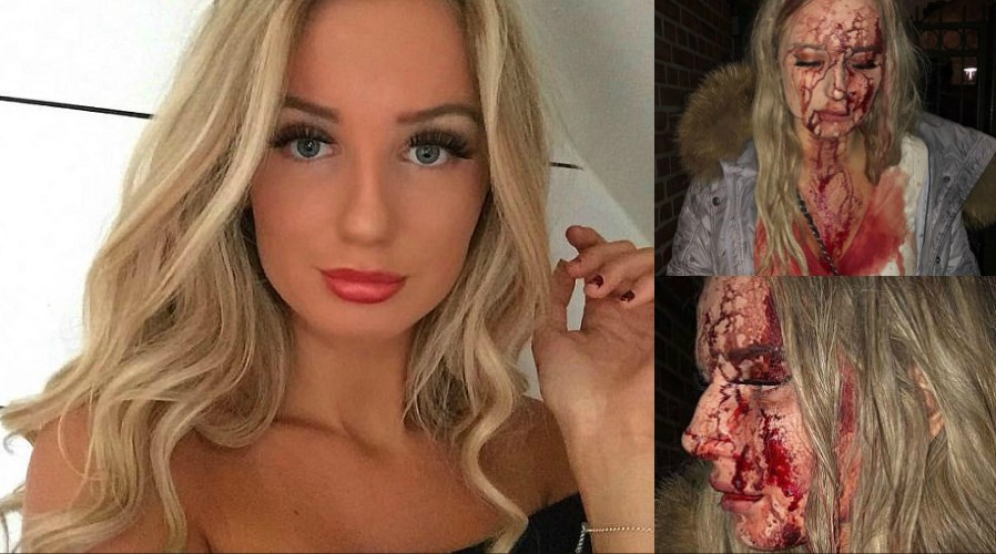 Ούτε σε ταινία τρόμου – Της έσπασε μπουκάλι στο κεφάλι γιατί αρνήθηκε να την “χουφτώσει” – ΦΩΤΟ