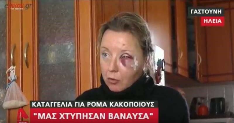 Εικόνες σοκ – Πήγαν να προστατέψουν γιαγιά που της έκλεβαν την τσάντα και τους ξυλοκόπησαν βάναυσα  – ΒΙΝΤΕΟ