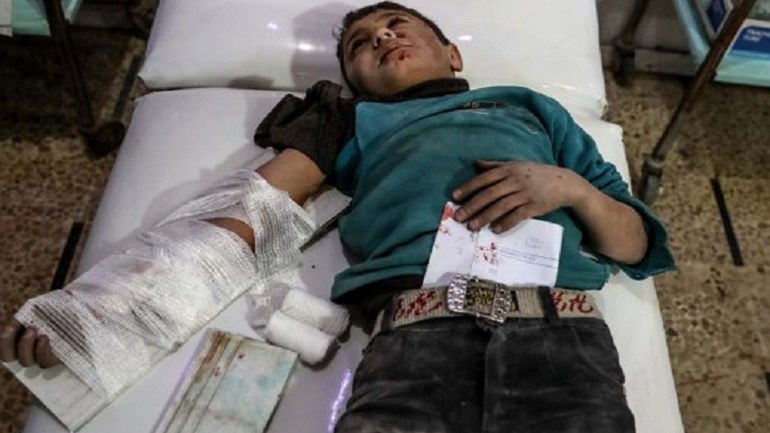 Προσοχή- Σκληρές εικόνες: Παιδιά χαροπαλεύουν στα νοσοκομεία μετά τους βομβαρισμούς στη Συρία – ΦΩΤΟ