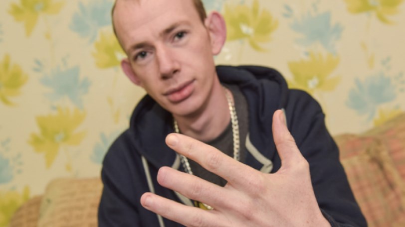 Βγήκε, τα ήπιε και όταν ξύπνησε του έλειπαν μνήμη και… ένα δάκτυλο – ΦΩΤΟ