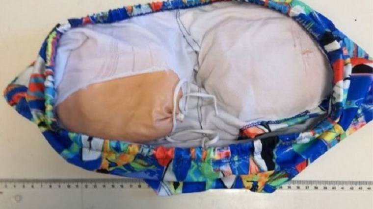 Βραζιλιάνος μετέφερε ένα κιλό κοκαϊνης σε ψεύτικα… οπίσθια