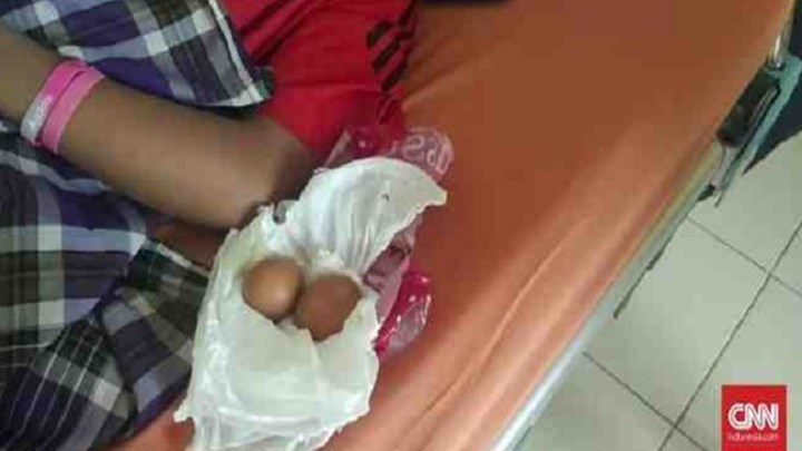Μυστήριο με τον 14χρονο που «γεννά» αυγά στην Ινδονησία- ΦΩΤΟ- ΒΙΝΤΕΟ