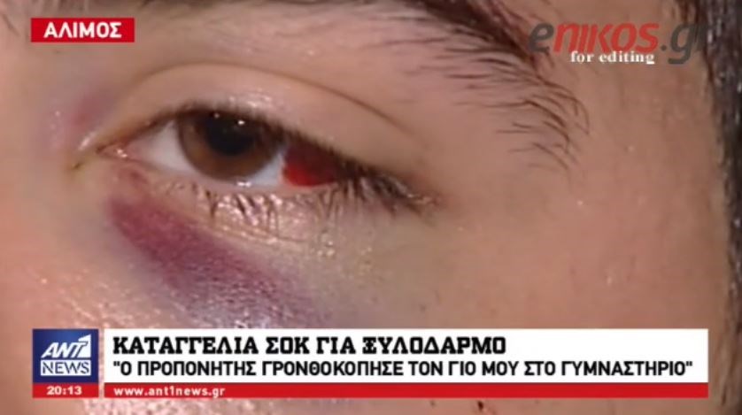 Καταγγελία σοκ για ξυλοδαρμό σε γυμναστήριο – Προπονητής γρονθοκόπησε τον γιο μου γιατί διαφώνησαν για…μία άσκηση – ΒΙΝΤΕΟ