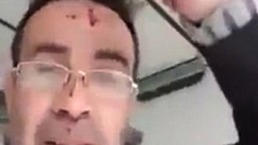 ΣΚΛΗΡΕΣ ΕΙΚOΝΕΣ – Έσφαξε τη γυναίκα του και μετά έκανε live στο Facebook: “Έτσι θα καταλήξετε αν εκνευρίζετε τους άντρες σας” – ΒΙΝΤΕΟ