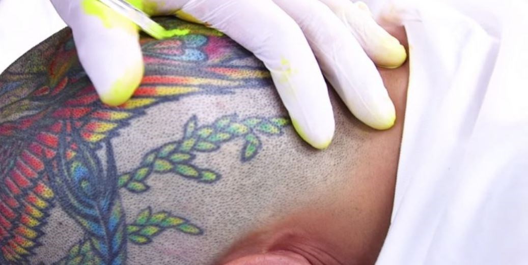 Γιατί τα τατουάζ δεν φεύγουν από το σώμα μας; – ΒΙΝΤΕΟ