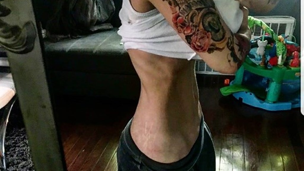 Σοκάρει η σκελετωμένη εικόνα της Ελληνίδας τραγουδίστριας – Δείτε τι έγραψε στο Instagram