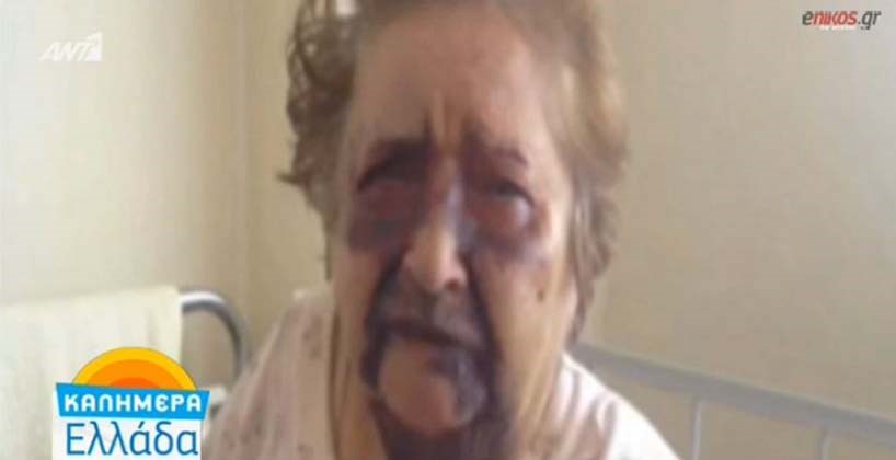 Σοκάρει η εικόνα της 84χρονης που έζησε τον τρόμο στα χέρια ληστών – Πώς περιγράφει τον εφιάλτη η κόρη της – ΒΙΝΤΕΟ