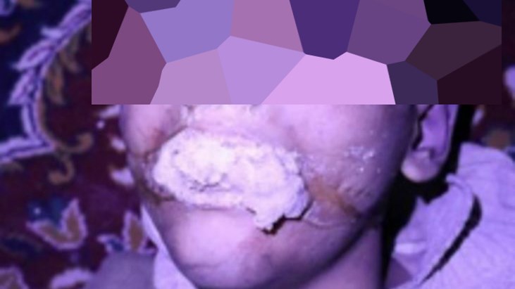 ΠΡΟΣΟΧΗ – Σκληρές εικόνες: Η Γαλλία έδωσε στη δημοσιότητα τις δικές της αποδείξεις για την επίθεση με χημικά στη Συρία – ΦΩΤΟ