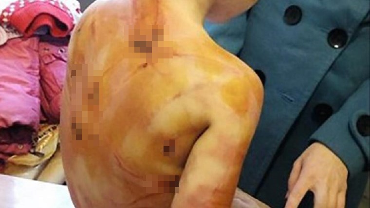 Φρίκη: Πατριός-κτήνος έδειρε ανελέητα 4χρονη επειδή δεν μπορούσε να μετρήσει μέχρι το πέντε – ΒΙΝΤΕΟ