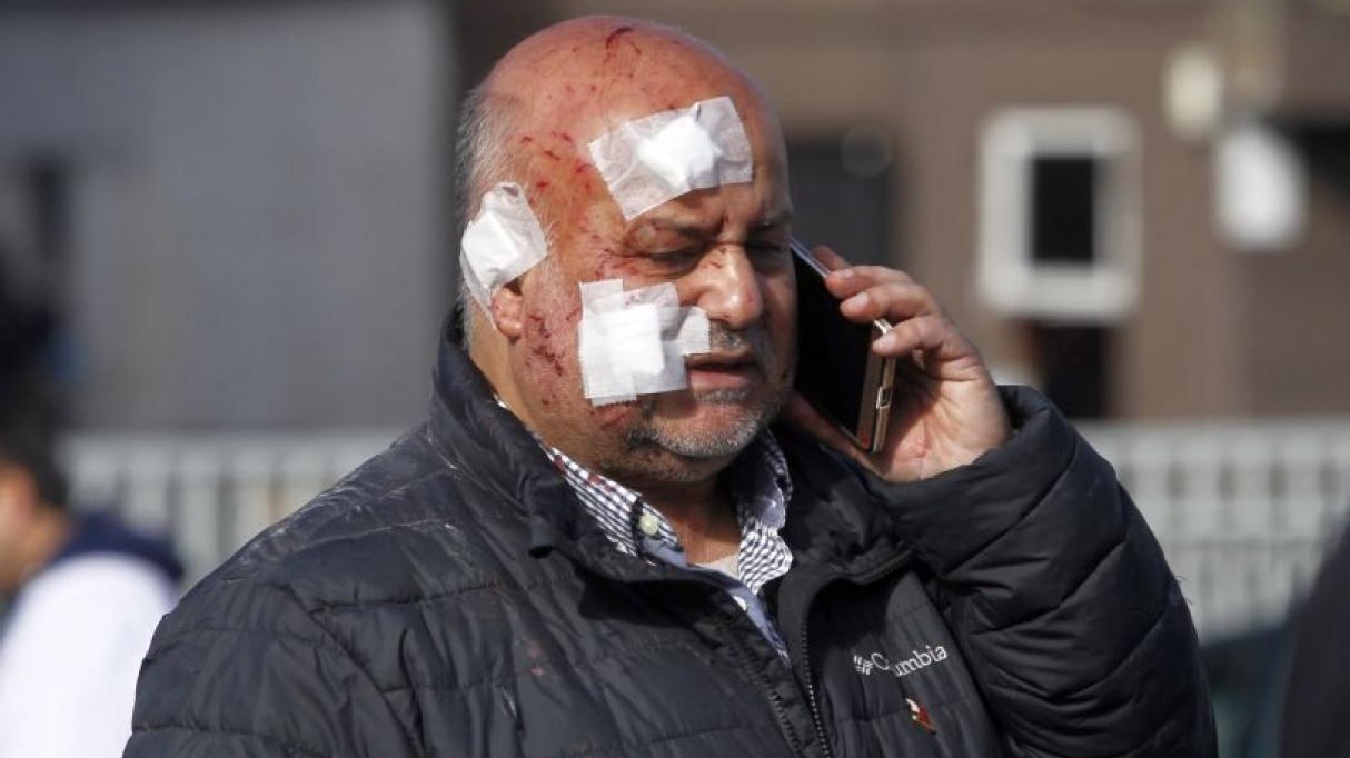 Τρεις νεκροί και πενήντα τραυματίες από έκρηξη σε νοσοκομείο στη Χιλή – ΦΩΤΟ