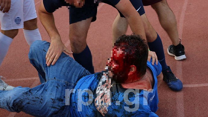 Άγρια επεισόδια στα Σπάτα σε αγώνα μπαράζ της Γ’ Εθνικής – ΦΩΤΟ