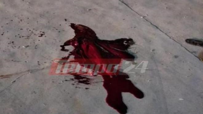 Τραγωδία στην Πάτρα: Νεκρός 17χρονος μετά από άγρια συμπλοκή μεταξύ μεταναστών – Έπεσαν πυροβολισμοί –  ΦΩΤΟ