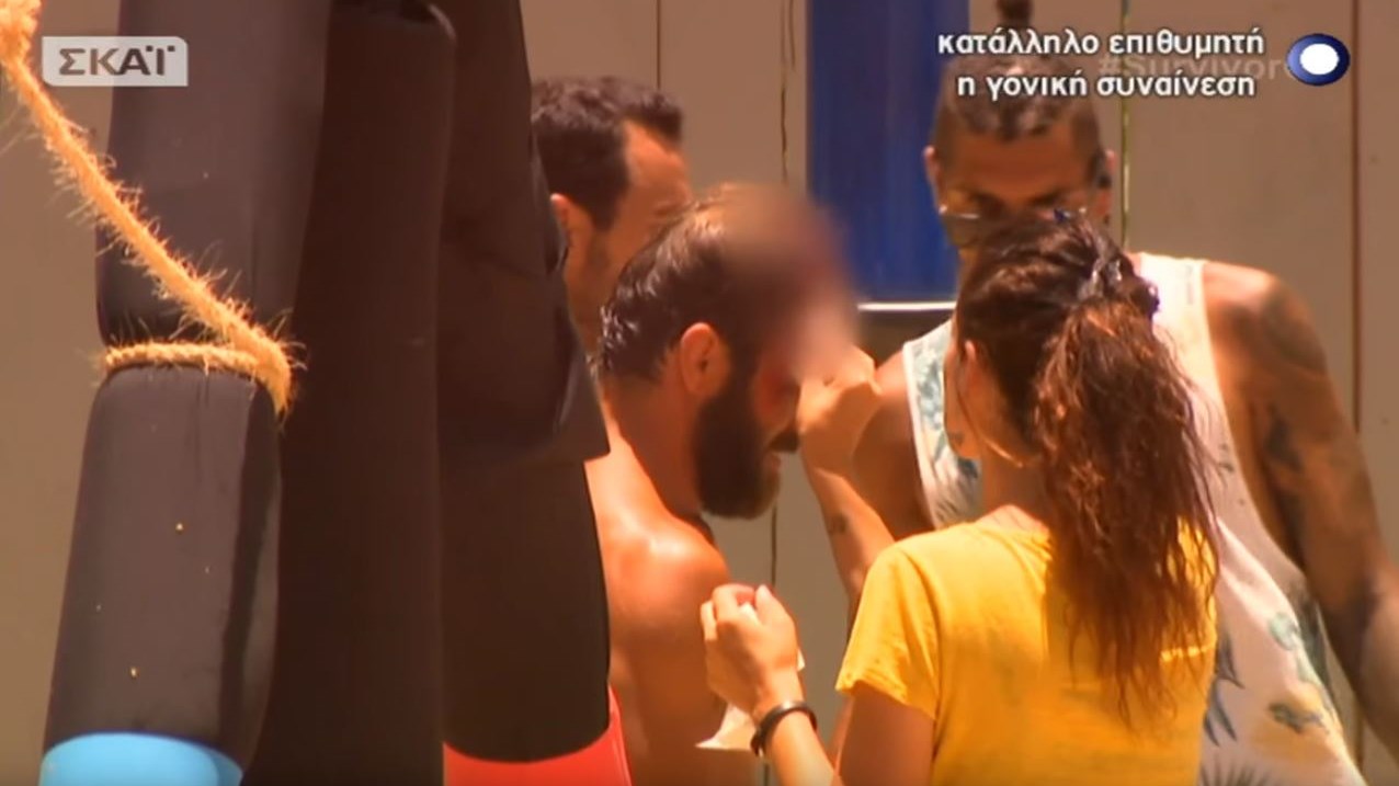 Survivor: Ο σοβαρός τραυματισμός του Τσεπάνη στο κεφάλι – ΒΙΝΤΕΟ
