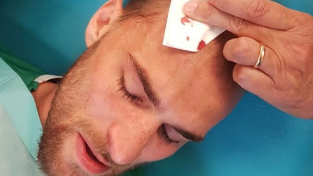 Ντοστ για την επίθεση των οπαδών της Σπόρτινγκ: Είναι ένα δράμα για όλους