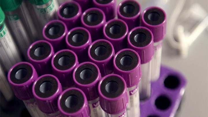 Έρευνα αποκαλύπτει ότι ουσία που χρησιμοποιείται ευρέως σε προϊόντα καθημερινής χρήσης συνδέεται με τον καρκίνο