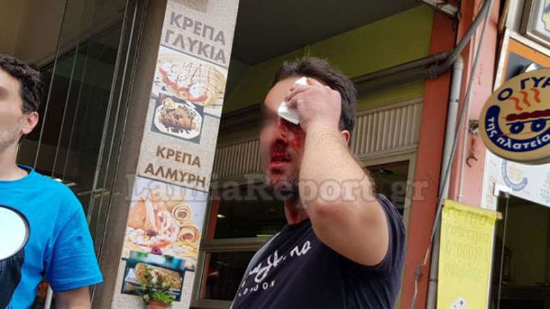 Άνοιξαν κεφάλια με καδρόνια στη Λαμία – Ο κακός χαμός στην πλατεία Πάρκου – ΦΩΤΟ