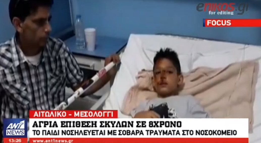 Σοκάρει η περιγραφή του 8χρονου- Δέχτηκε άγρια επίθεση από σκυλιά – ΒΙΝΤΕΟ