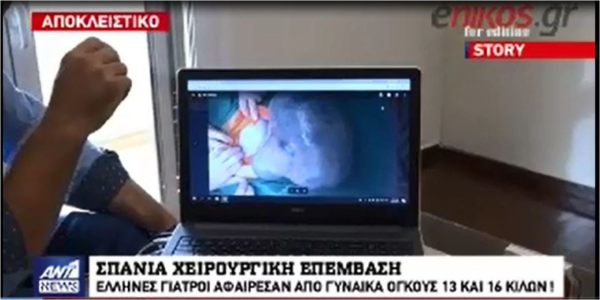 Αποκλειστικό ΑΝΤ1: Σπάνια χειρουργική επέμβαση – Έλληνες γιατροί αφαίρεσαν από γυναίκα όγκους 13 και 16 κιλών – ΒΙΝΤΕΟ