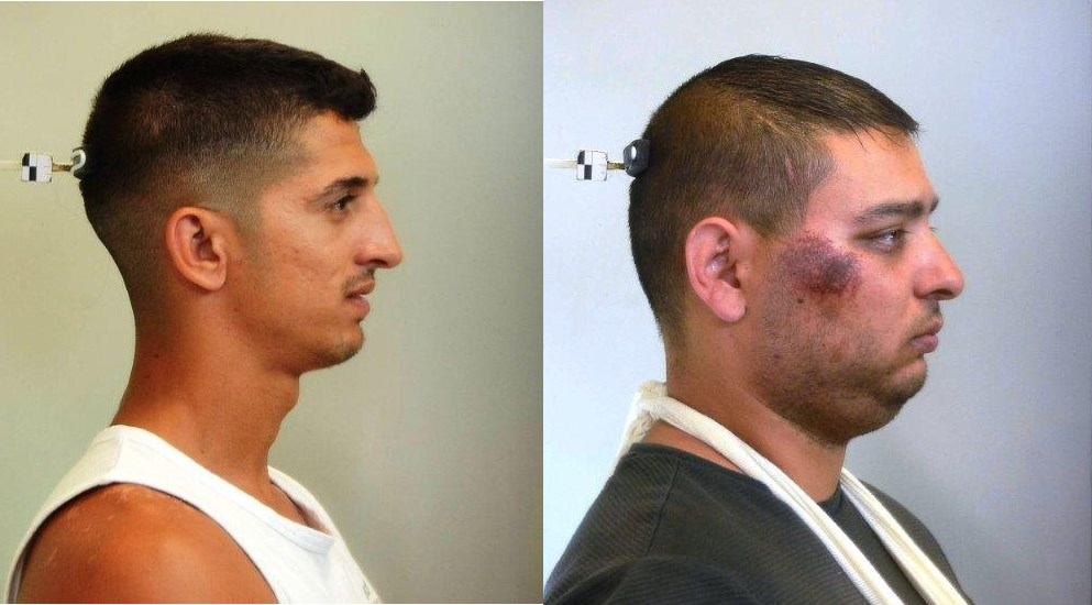 ΕΛ.ΑΣ: Αυτοί είναι οι ληστές που είχαν “ρημάξει” την Αγία Παρασκευή – “Ήρθαμε για το ασανσέρ” έλεγαν και… – ΦΩΤΟ