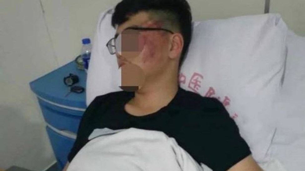 Δάσκαλος χαστούκισε μαθητή – Σοκάρουν οι φωτογραφίες