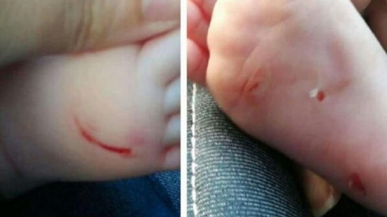 Αποκλειστικό του ΑΝΤ1: Βίντεο ντοκουμέντο με τη γυναίκα που χαράκωνε μωρά