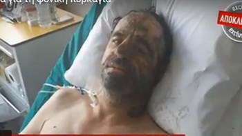 Συγκλονίζει η μαρτυρία εγκαυματία της φονικής πυρκαγιάς: Η φωτιά έτρεχε σαν δαιμονισμένη – ΒΙΝΤΕΟ