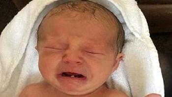 Στον οδοντίατρο για εξαγωγή δοντιού σε ηλικία μόλις 12 ημερών – ΦΩΤΟ