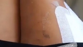 Οι πρώτες φωτογραφίες του μοντέλου του My Style Rocks από το νοσοκομείο – ΦΩΤΟ