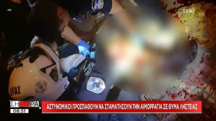 Σωτήρια παρέμβαση αστυνομικών της ομάδας ΔΙΑΣ- Σταμάτησαν την αιμορραγία σε θύμα ληστείας – Σκληρές εικόνες