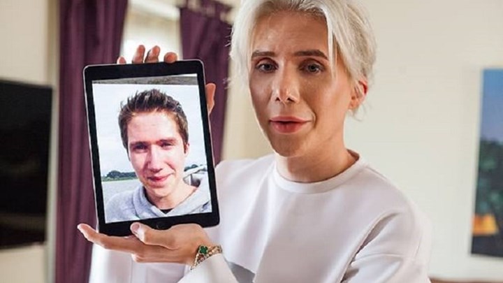 Ξόδεψε 86.000 ευρώ για να μοιάσει στο ίνδαλμά του – Άλλαξε ακόμη και το σχήμα των ματιών του – ΦΩΤΟ – ΒΙΝΤΕΟ