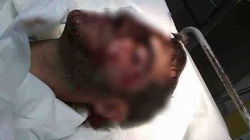 Καταγγελία για επίθεση σκύλου σε 33χρονο