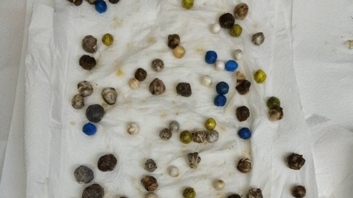 Κρατούμενος προσπάθησε να μεταφέρει ναρκωτικά στο στομάχι του – ΦΩΤΟ