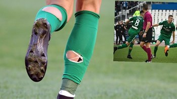 Το μυστικό με τις…σκισμένες κάλτσες στον Παναθηναϊκό – ΦΩΤΟ
