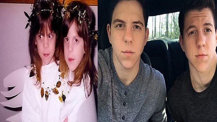 Συγκλονιστική ιστορία: Δίδυμα κορίτσια αποκάλυψαν ότι είναι τρανσέξουαλ και χειρουργήθηκαν μαζί – ΦΩΤΟ