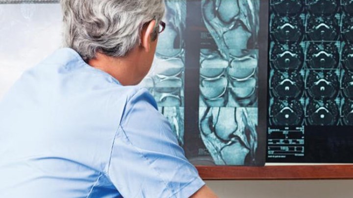 “Μαχαίρι” ΕΟΠΥΥ σε αξονικές και μαγνητικές τομογραφίες – Βάσει πλαφόν οι εξετάσεις ασφαλισμένων